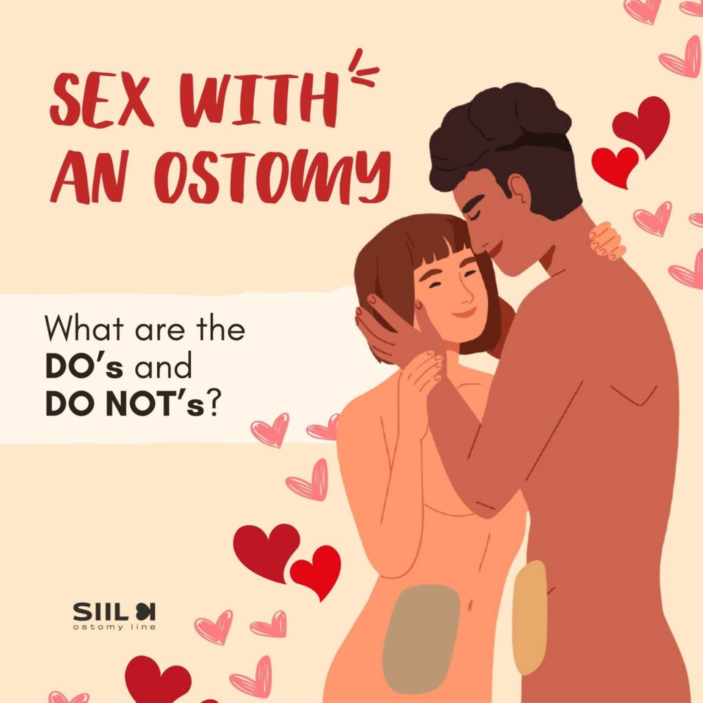 Ostomy Sexuality