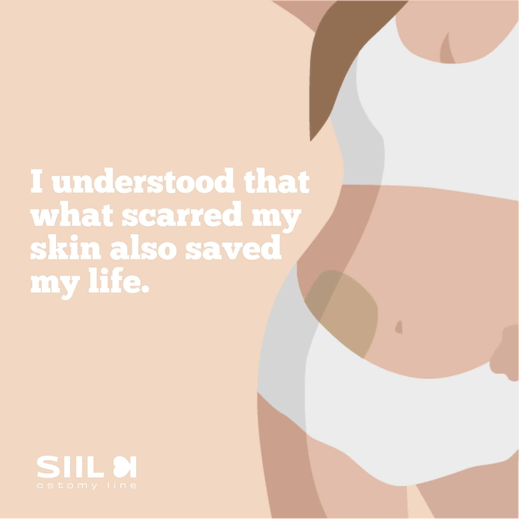 The importance of internal positive dialogue for Ostomates | SIIL Ostomy