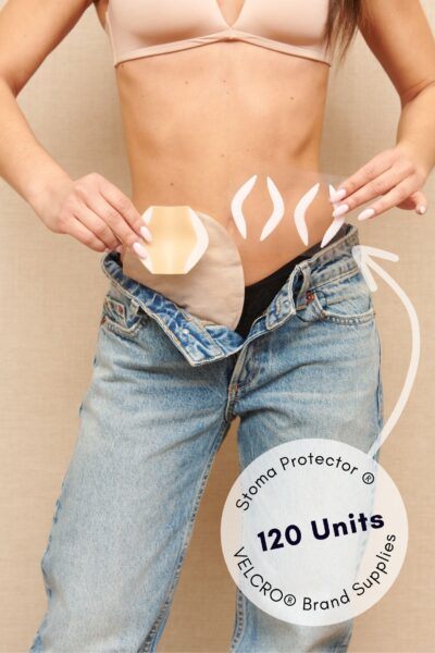 stoma protector