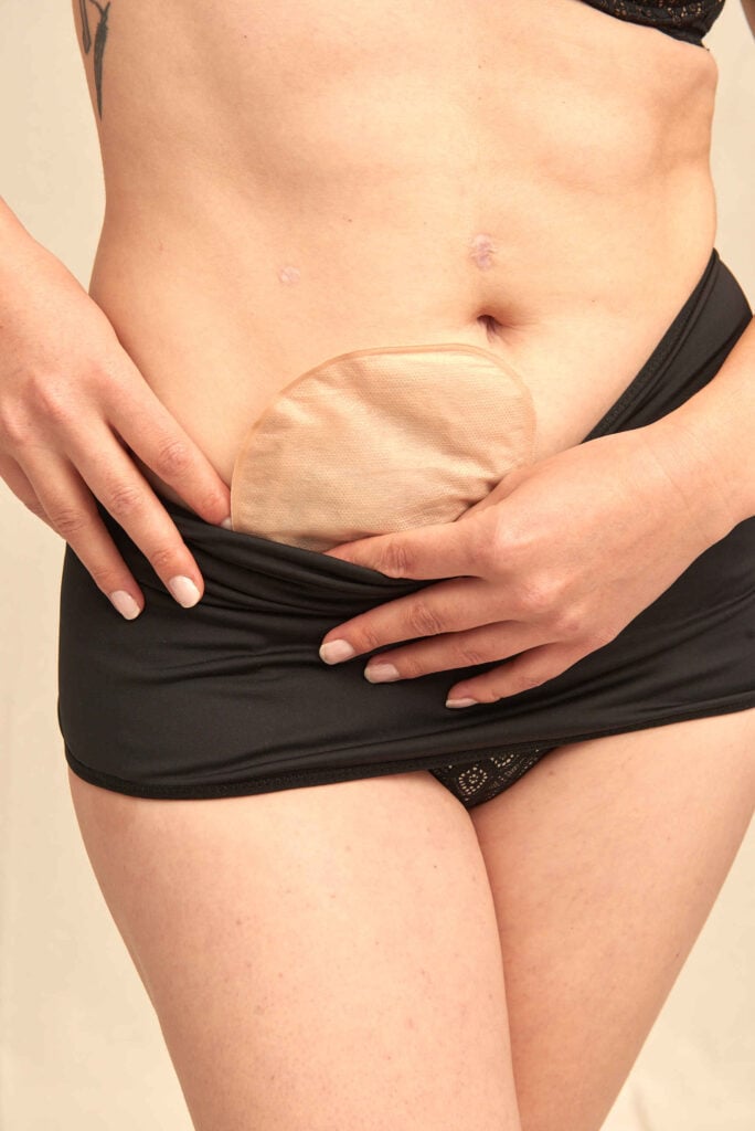 Ostomy Products | Colostomy Bag Covers | SIIL Ostomy | Ostomy Belt | Ileostomy Underwear