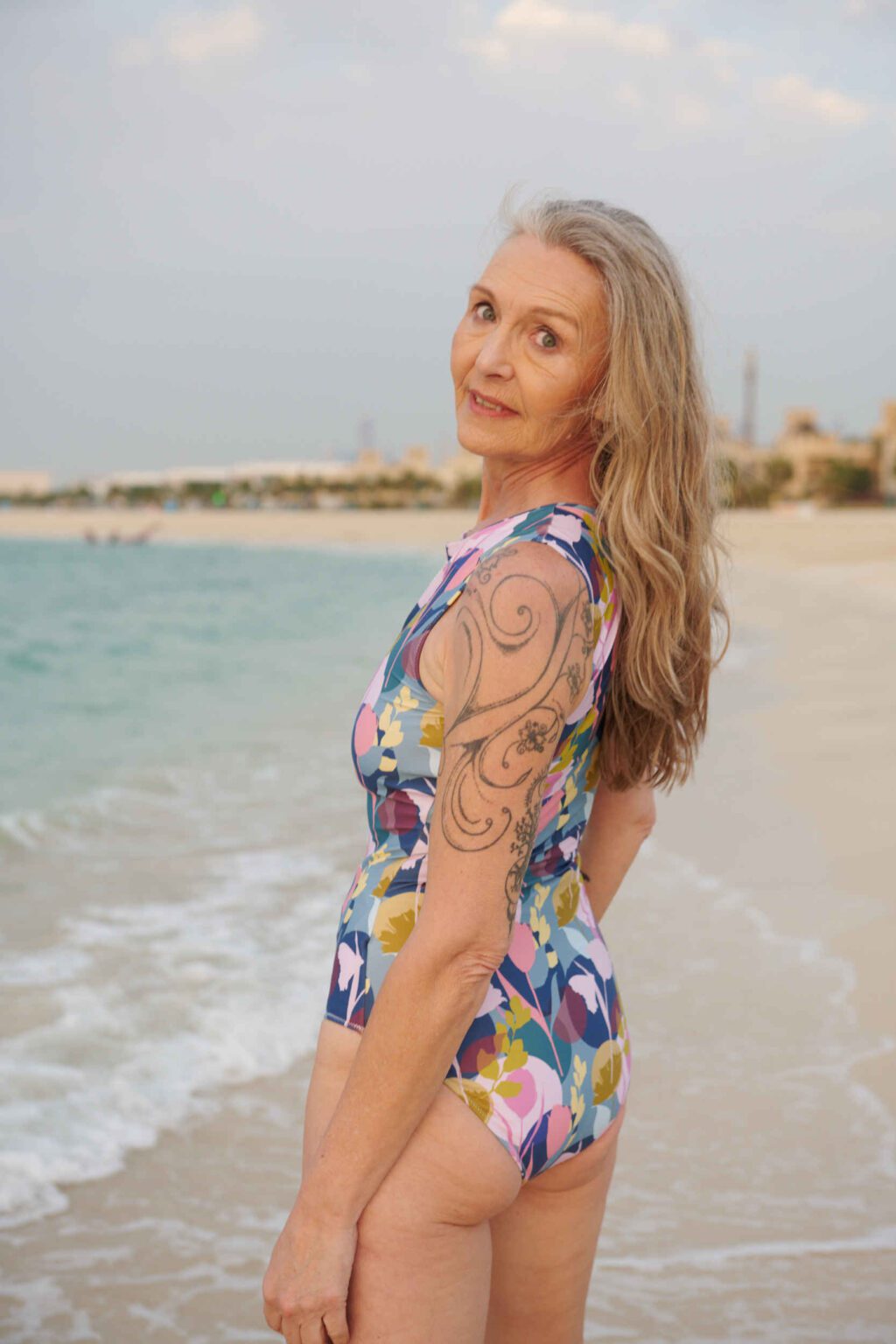 siil ostomy _dsc3436