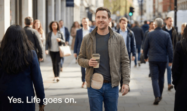 Can you lead a normal life with a stoma bag