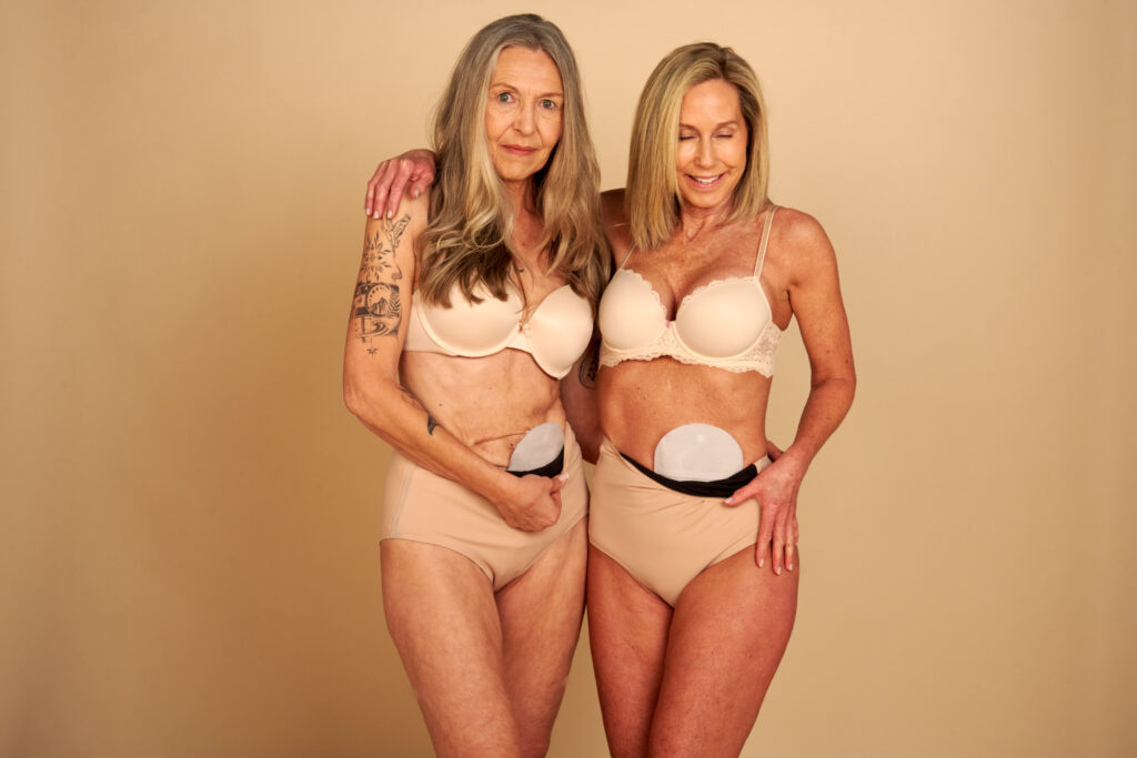 beige ostomy bag cover panties for women two women in beige lingerie with high-waist ostomy panties as ostomy bag covers
