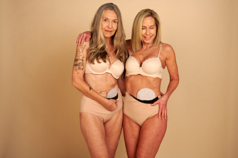 Siilostomy Dubai345487